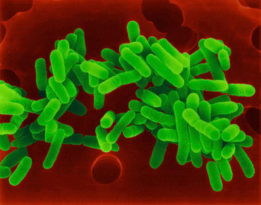 Legionella