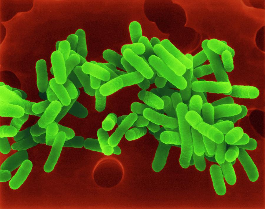 Legionella
