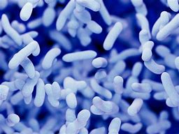 legionella 